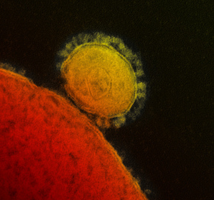 Coronavirus : de nouveaux cas suspects en France