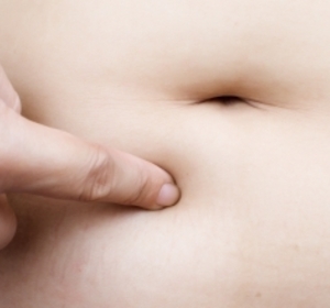 Lutte contre l’obésité : trop de chirurgie pour l’Assurance-maladie